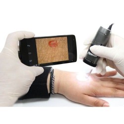 Video Dermatoscop USB pentru dermatoscopie computerizata de inalta rezolutie - 5 Mpx Video Dermatoscop USB pentru dermatoscopie computerizata de inalta rezolutie - 5 Mpx